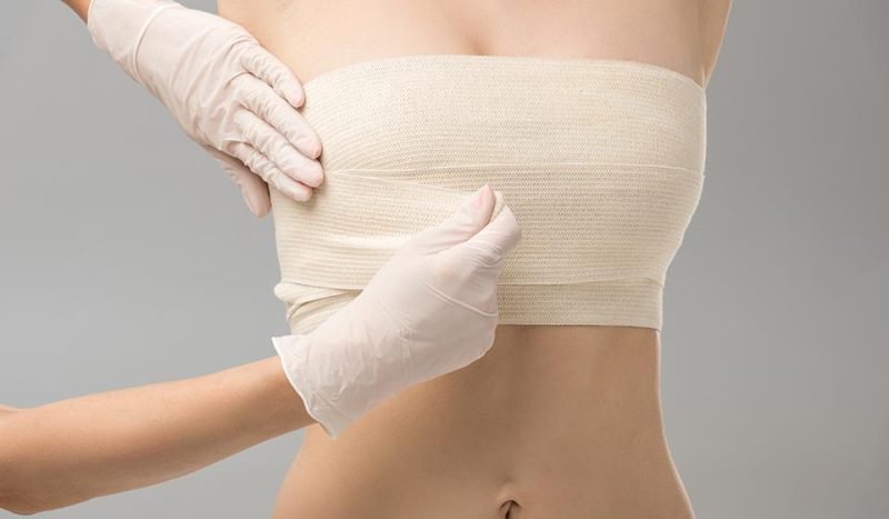5 Ways To Reduce Bruising and Swelling After Breast Reduction Surgery