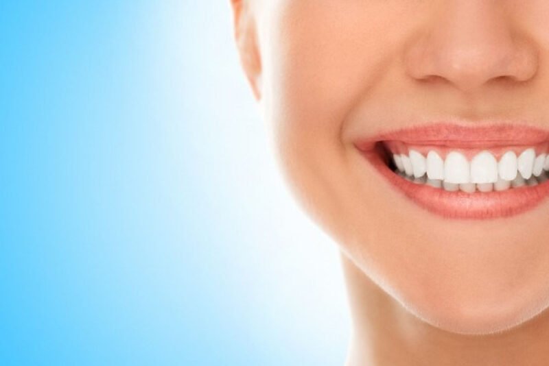 Elevating Smiles: Unveiling the Magic of Porcelain Veneers